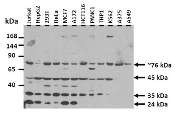 KMT5B Rabbit Polyclonal Antibody