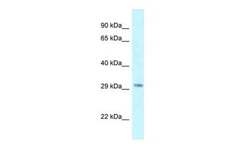 KMT5B Rabbit Polyclonal Antibody