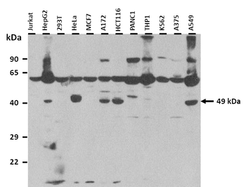 DPH1 Rabbit Polyclonal Antibody