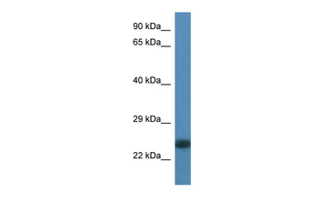 MYL6B Rabbit Polyclonal Antibody