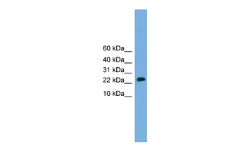 CSH2 Rabbit Polyclonal Antibody