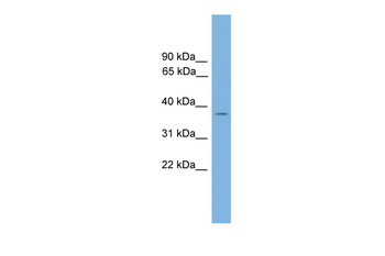 GALM Rabbit Polyclonal Antibody