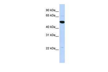 RP13-102H20.1 Rabbit Polyclonal Antibody