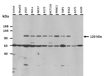 KLB Rabbit Polyclonal Antibody