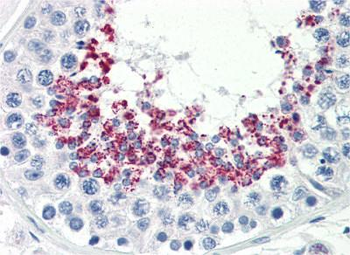 KLB Rabbit Polyclonal Antibody