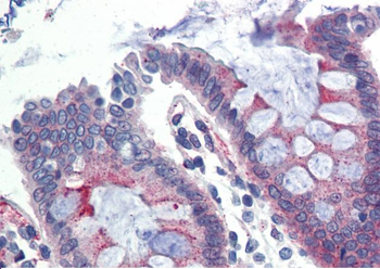 KLB Rabbit Polyclonal Antibody