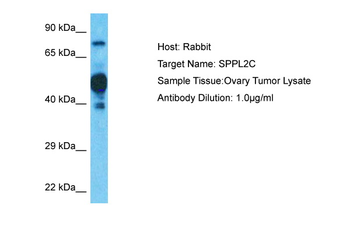 SPPL2C Rabbit Polyclonal Antibody