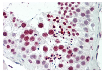 TNP1 Rabbit Polyclonal Antibody