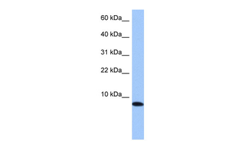 TNP1 Rabbit Polyclonal Antibody