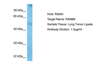 RANBP9 Rabbit Polyclonal Antibody