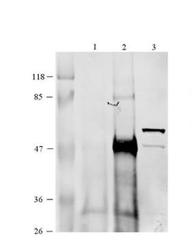 CCT6B Rabbit Polyclonal Antibody