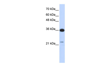 C20orf10 Rabbit Polyclonal Antibody