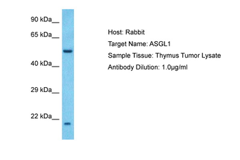 ASRGL1 Rabbit Polyclonal Antibody