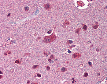 FKBP5 Rabbit Polyclonal Antibody