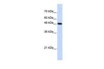 POLM Rabbit Polyclonal Antibody