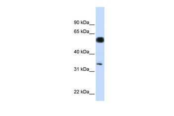 C19orf62 Rabbit Polyclonal Antibody