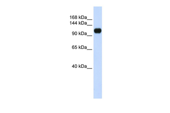 KIAA0692 Rabbit Polyclonal Antibody