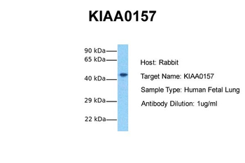 ABRAXAS2 Rabbit Polyclonal Antibody