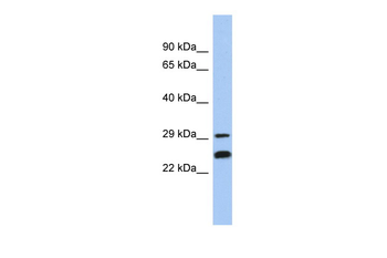 NSMCE2 Rabbit Polyclonal Antibody