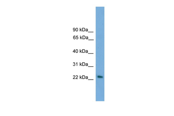 RAB15 Rabbit Polyclonal Antibody