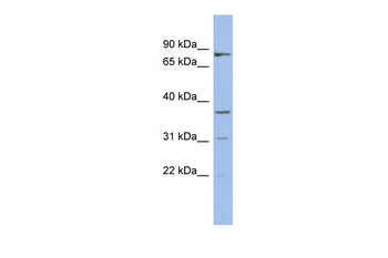 OLAH Rabbit Polyclonal Antibody