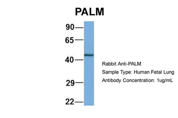 PALM Rabbit Polyclonal Antibody