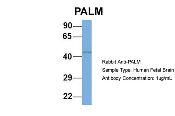 PALM Rabbit Polyclonal Antibody