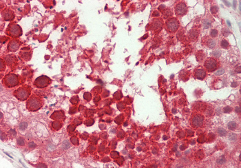 Ubl5 Rabbit Polyclonal Antibody