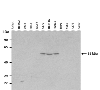 MYBPH Rabbit Polyclonal Antibody