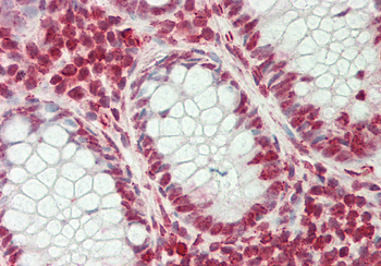 C22orf28 Rabbit Polyclonal Antibody