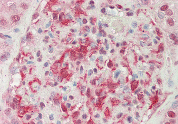 C22orf28 Rabbit Polyclonal Antibody