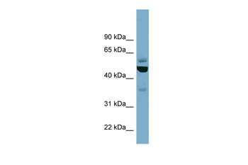 TUBE1 Rabbit Polyclonal Antibody