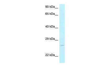 Ak3 Rabbit Polyclonal Antibody