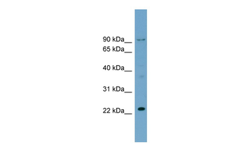 C15orf15 Rabbit Polyclonal Antibody