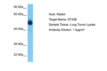 STK32B Rabbit Polyclonal Antibody