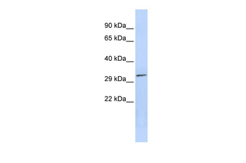 PDXP Rabbit Polyclonal Antibody