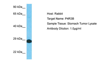 PPP4R3B Rabbit Polyclonal Antibody