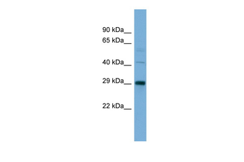 CELA2A Rabbit Polyclonal Antibody