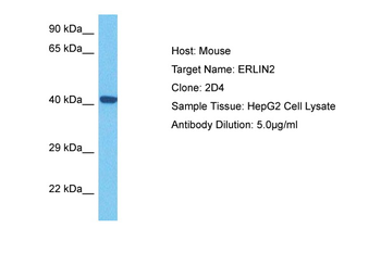ERLIN2 Rabbit Polyclonal Antibody