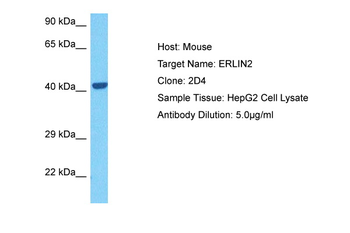 ERLIN2 Rabbit Polyclonal Antibody