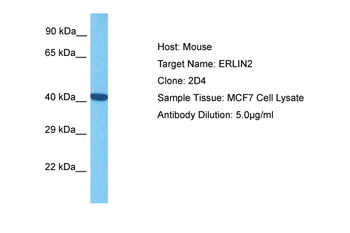 ERLIN2 Rabbit Polyclonal Antibody