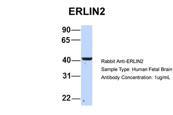 ERLIN2 Rabbit Polyclonal Antibody