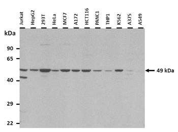 HNRPH1 Rabbit Polyclonal Antibody