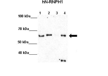 HNRPH1 Rabbit Polyclonal Antibody