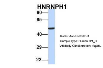 HNRPH1 Rabbit Polyclonal Antibody