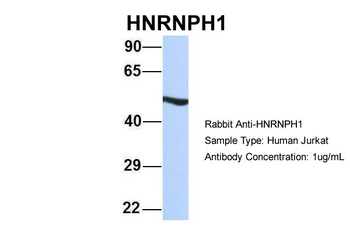 HNRPH1 Rabbit Polyclonal Antibody