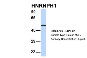 HNRPH1 Rabbit Polyclonal Antibody