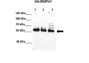 HNRPH1 Rabbit Polyclonal Antibody