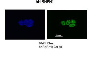 HNRPH1 Rabbit Polyclonal Antibody