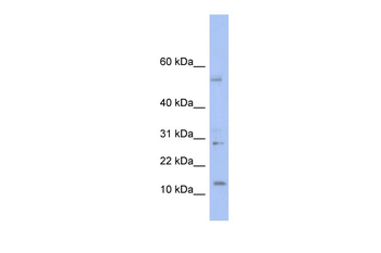 TD1 Rabbit Polyclonal Antibody